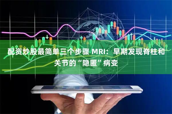 配资炒股最简单三个步骤 MRI：早期发现脊柱和关节的“隐匿”病变
